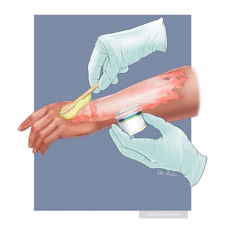 burn wound care
