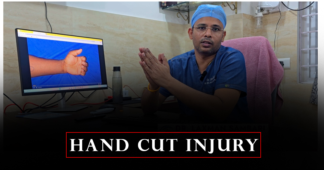 Treating  Hand  Cut  Injuries  at  Vedha Multi-Speciality  Hospital,  Hanumakonda