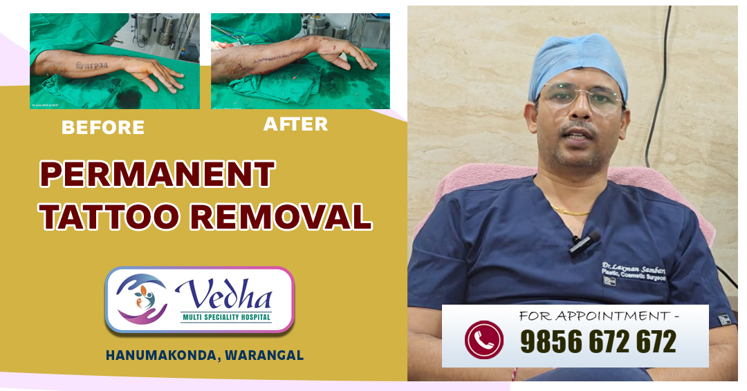 Permanent Tattoo Removal by Dr. Laxman Sambari