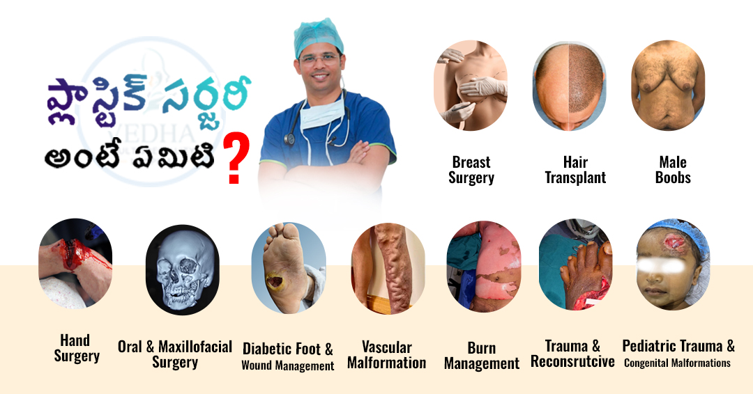 What is Plastic Surgery?