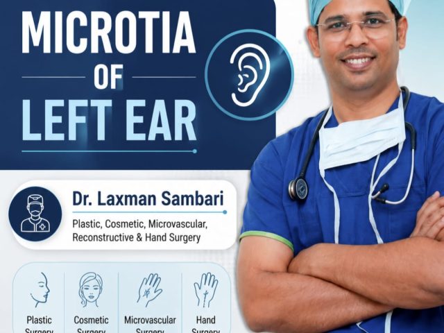 Microtia (Left Ear) Reconstruction Surgery