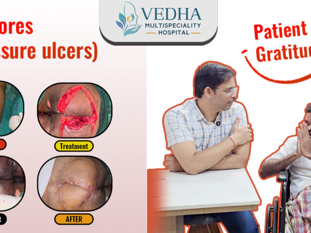 Patient Stories – Bedsores (pressure ulcers)