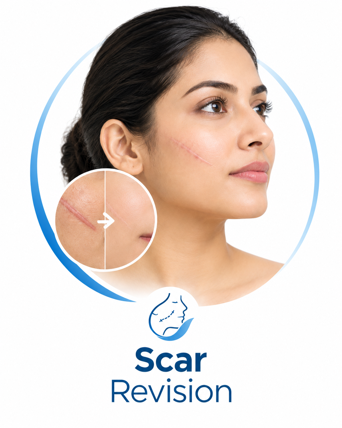Scar Revision​