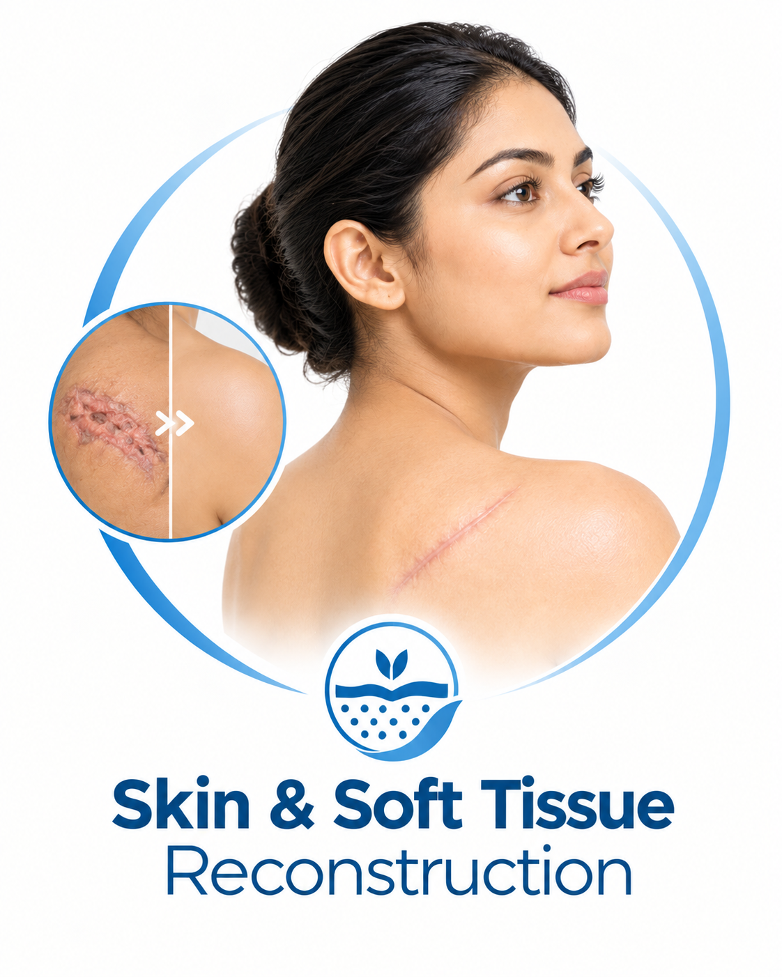 Skin & Soft Tissue Reconstructions