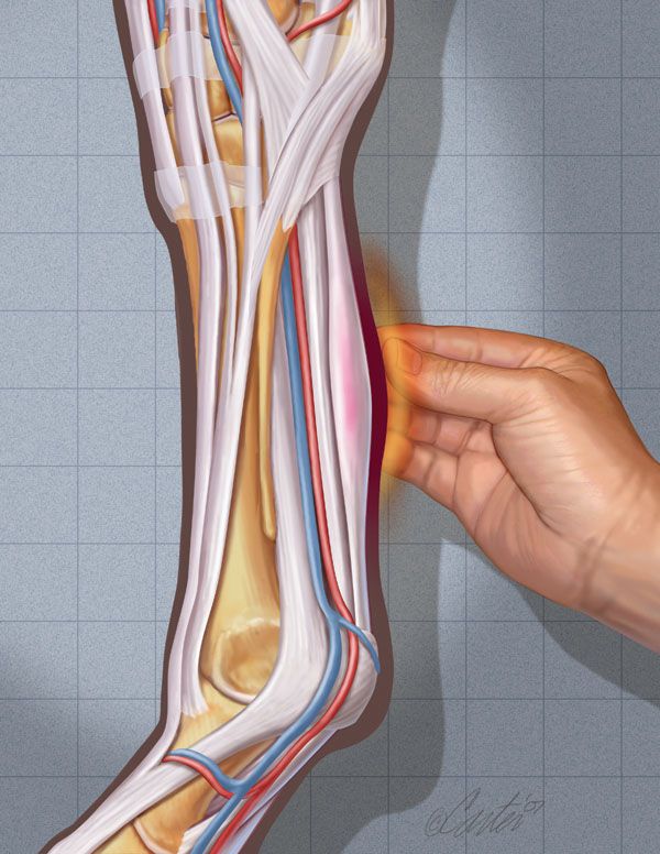 soft tissue injuries